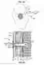 Fig. 05 - PNEUMOSTOMA MANAGEMENT SYSTEM PACKAGING AND KITS