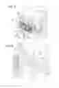 Fig. 05 - Personal hemodialysis system including priming sequence and methods of same
