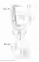 Fig. 10 - Personal hemodialysis system including priming sequence and methods of same
