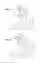 Fig. 11 - Personal hemodialysis system including priming sequence and methods of same