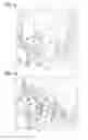 Fig. 13 - Personal hemodialysis system including priming sequence and methods of same