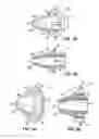 Fig. 07 - Multiple component dispensing cartridge, mixing nozzle and method for reducing contact between fluids