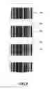 Fig. 06 - Length measurement system based on optical recognition pattern for length measurement
