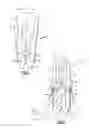 Fig. 03 - Cantilevered differential motion sensor and associated frame