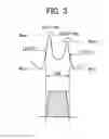 Fig. 04 - Charged particle beam device