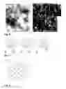 Fig. 04 - Fluorescence light scanning microscope having a birefringent chromatic beam shaping device