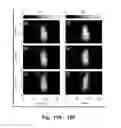 Fig. 15 - System, method, and luminescent marker for improved diffuse luminescent imaging or tomography in scattering media