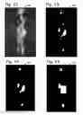 Fig. 07 - Surveillance with subject screening