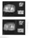 Fig. 04 - Visualization of deformations using color overlays