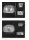Fig. 05 - Visualization of deformations using color overlays