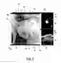 Fig. 06 - Visualization apparatus