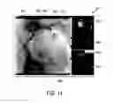 Fig. 15 - Visualization apparatus