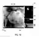 Fig. 17 - Visualization apparatus