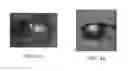 Fig. 05 - Methods and apparatuses for using image acquisition data to detect and correct image defects