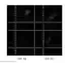 Fig. 07 - Methods and apparatuses for using image acquisition data to detect and correct image defects