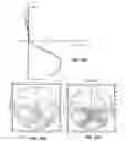 Fig. 13 - Method And Apparatus For Designing An Optical Lens