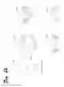 Fig. 04 - Lamp Cover