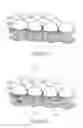 Fig. 09 - Beam shaper