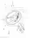 Fig. 06 - Graded resolution field of view CT scanner