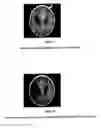 Fig. 06 - Method and apparatus for radiation imaging