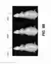 Fig. 17 - APPARATUS AND METHOD FOR MULTI-MODAL IMAGING USING MULTIPLE X-RAY SOURCES