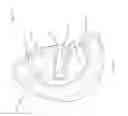Fig. 04 - Fluoroscopy operator protection device