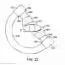 Fig. 22 - Fluoroscopy operator protection device