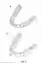 Fig. 06 - Smile designer