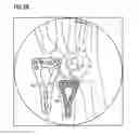 Fig. 07 - Method and a system for assessing the relative pose of an implant and a bone of a creature