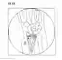 Fig. 09 - Method and a system for assessing the relative pose of an implant and a bone of a creature