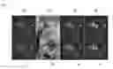 Fig. 01 - Systems and methods for computer aided analysis of images