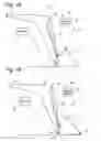 Fig. 02 - Implement attaching to a forward motion-producing machine for elevating an edge encountering an immovable object