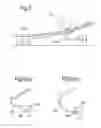 Fig. 04 - Annulus filler