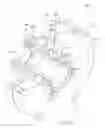 Fig. 06 - Mechanical seal with improved seal assembly