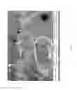 Fig. 11 - METHOD FOR THE SYNTHESIS OF CARBON NANOTUBES ON LONG PARTICULATE MICROMETRIC MATERIALS