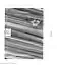 Fig. 16 - METHOD FOR THE SYNTHESIS OF CARBON NANOTUBES ON LONG PARTICULATE MICROMETRIC MATERIALS