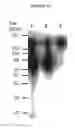 Fig. 11 - Cytotoxicity Mediation of Cells Evidencing Surface Expression of CD44