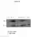 Fig. 44 - Cytotoxicity Mediation of Cells Evidencing Surface Expression of CD44