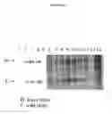 Fig. 45 - Cytotoxicity Mediation of Cells Evidencing Surface Expression of CD44