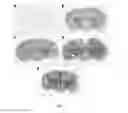 Fig. 10 - PEPTIDE-MEDIATED NON-COVALENT DELIVERY OF ACTIVE AGENTS ACROSS THE BLOOD-BRAIN BARRIER