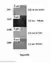 Fig. 07 - Method for forming cyclodextrin polymer and lipophilic compound emulsions, resulting emulsions, and compositions including said emulsions