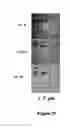 Fig. 22 - Method for forming cyclodextrin polymer and lipophilic compound emulsions, resulting emulsions, and compositions including said emulsions
