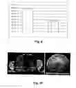 Fig. 07 - Stem cells for transplantation and methods for production thereof