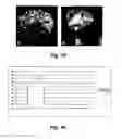 Fig. 11 - Stem cells for transplantation and methods for production thereof