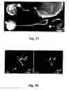 Fig. 12 - Stem cells for transplantation and methods for production thereof