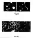 Fig. 15 - Stem cells for transplantation and methods for production thereof
