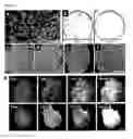 Fig. 02 - Induced pluripotent stem cell produced by transfecting a human neural stem cell with an episomal vector encoding the Oct4 and Nanog proteins