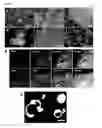 Fig. 03 - Induced pluripotent stem cell produced by transfecting a human neural stem cell with an episomal vector encoding the Oct4 and Nanog proteins
