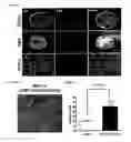 Fig. 08 - Induced pluripotent stem cell produced by transfecting a human neural stem cell with an episomal vector encoding the Oct4 and Nanog proteins
