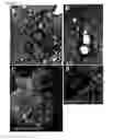 Fig. 12 - Induced pluripotent stem cell produced by transfecting a human neural stem cell with an episomal vector encoding the Oct4 and Nanog proteins